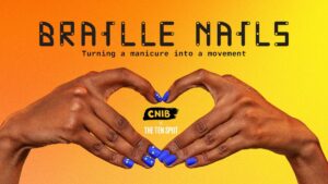 CNIB 